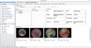 Phần mềm in trả kết quả nội soi, siêu âm