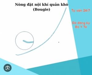 Nong đặt nội khí quản khó ( Bougie)